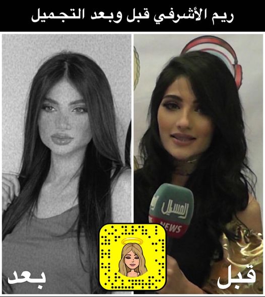 ريم الأشرفي قبل وبعد التجميل