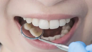 علاج الم الاسنان