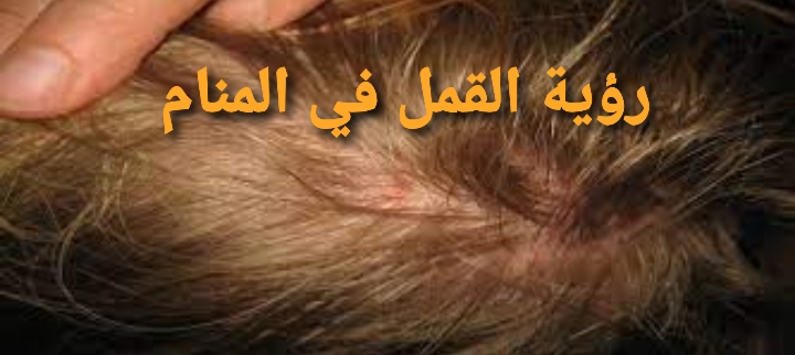 تفسير القمل في الحلم للمتزوجة والعزباء والرجل