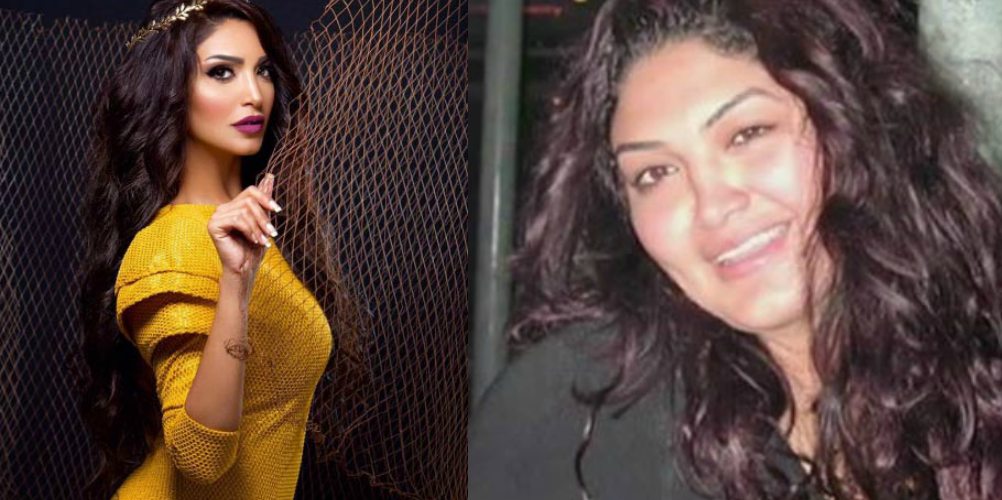 صور سالى عبدالسلام قبل وبعد عملية التجميل والتحسيس