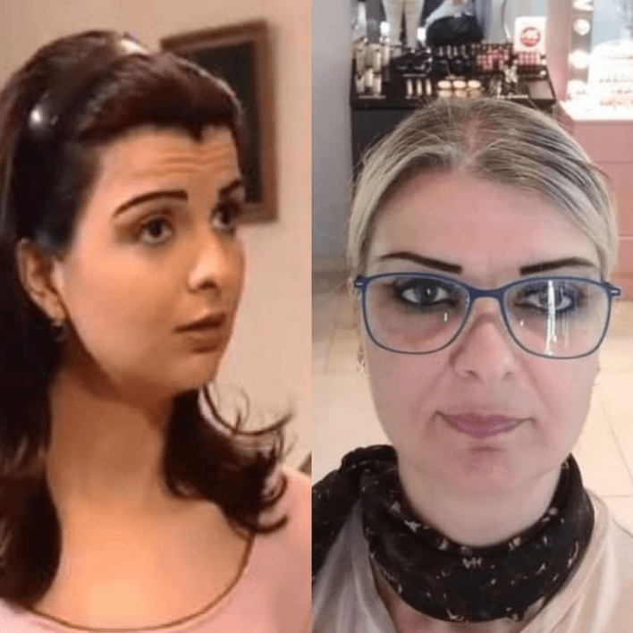 صور رباب كنعان قبل وبعد التجميل