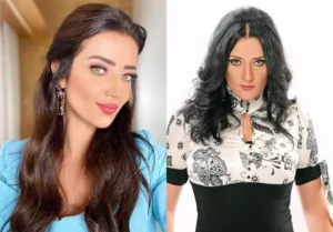 صور رضوى الشربيني قبل وبعد