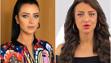 صور رضوى الشربيني قبل وبعد عملية التجميل