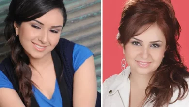 صور شهدا برمدا قبل وبعد عملية التجميل