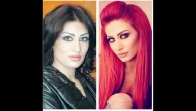صور هبة زهرة الممثلة السورية قبل وبعد التجميل