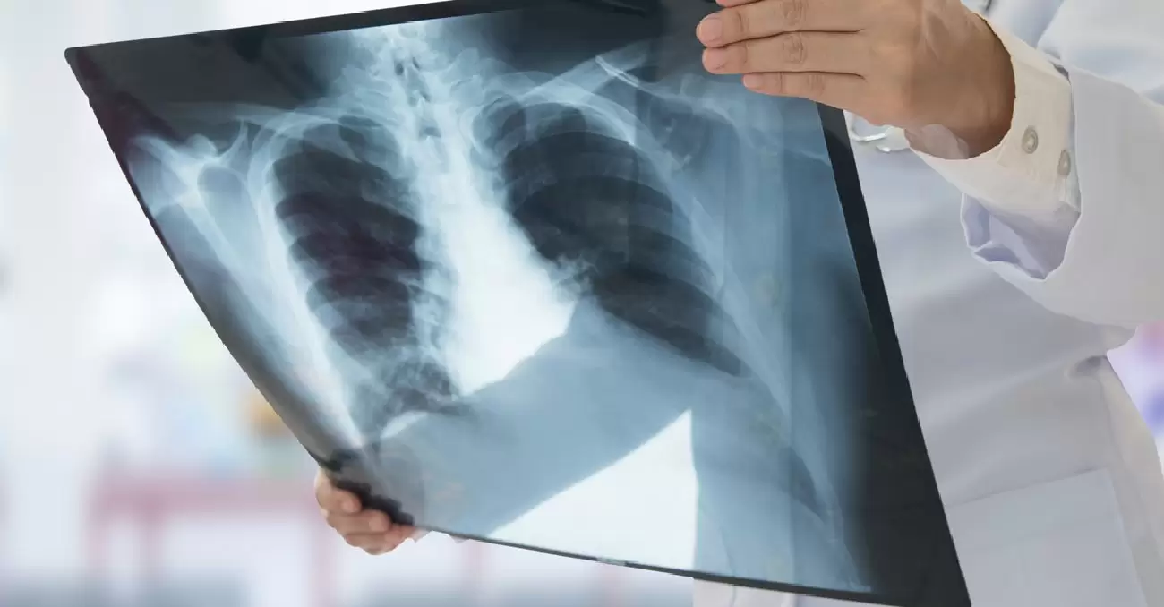 نسب القبول في تخصص الأشعة 1445 وعدد سنوات الدراسة