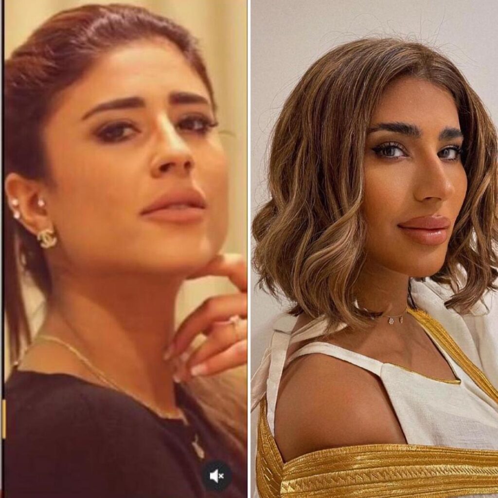 من هي ليلي عبدالله قبل وبعد التجميل